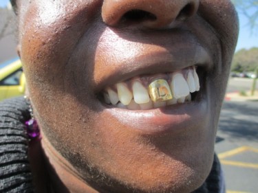 Anderson's said the 'L' on her gold front tooth stands for 'Love,' as well as her first name. 