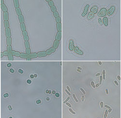 Examples of cyanobacteria (Photos courtesy of Galyna Kufryk)